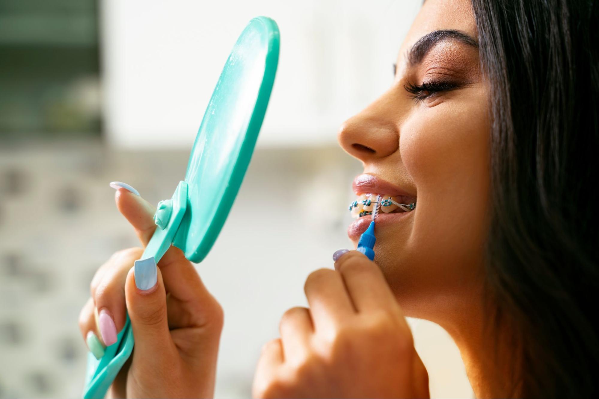 How to Keep Your Teeth Clean With Braces