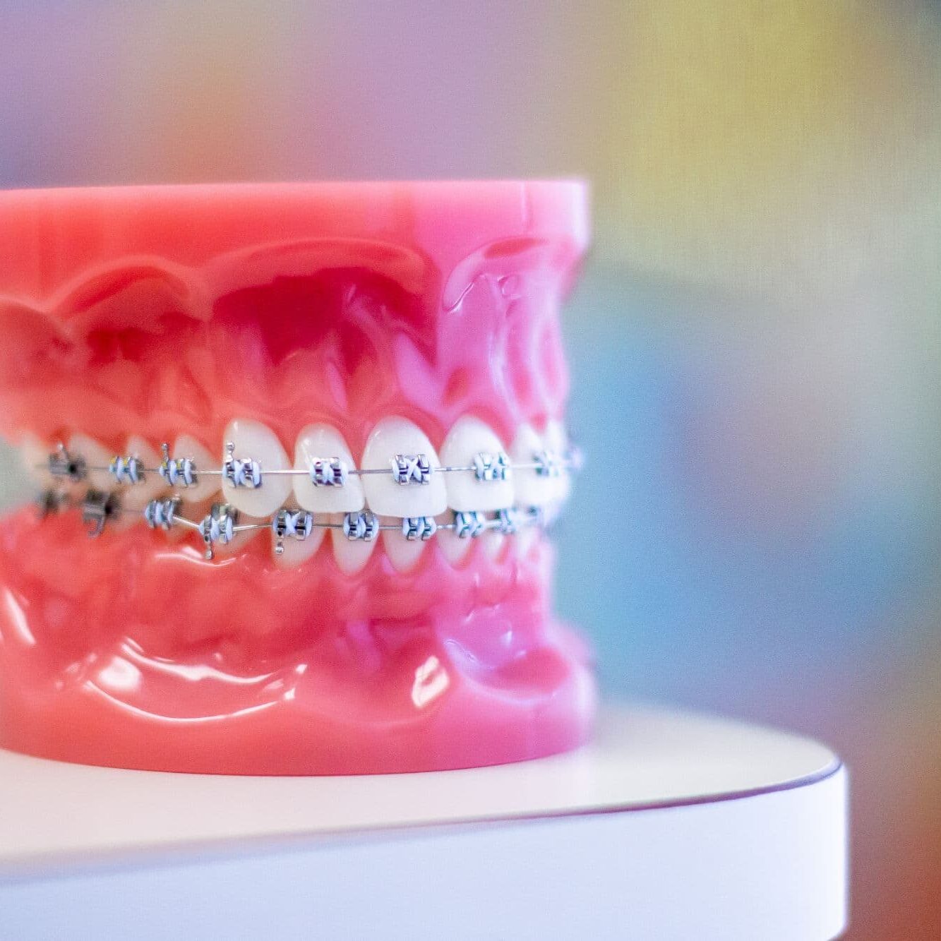 Metal Braces